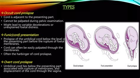 what is the difference between cord presentation and cord prolapse