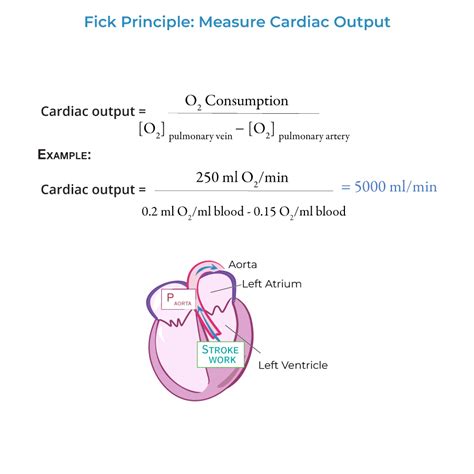 what is the equation used to calculate cardiac output