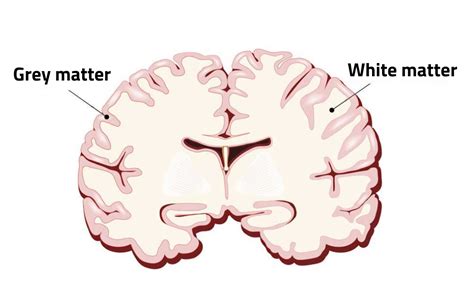 what is the grey matter in the brain made of