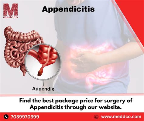 what is the meaning of appendix surgery