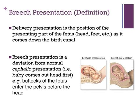 what is the meaning of presentation in pregnancy