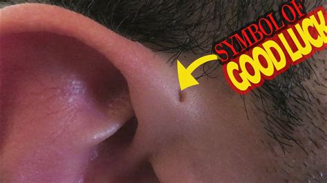 what is the meaning of tiny hole on the ear