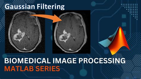 what is the primary purpose of using a gaussian filter in medical image processing