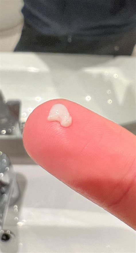 what is thick white mucus from nose
