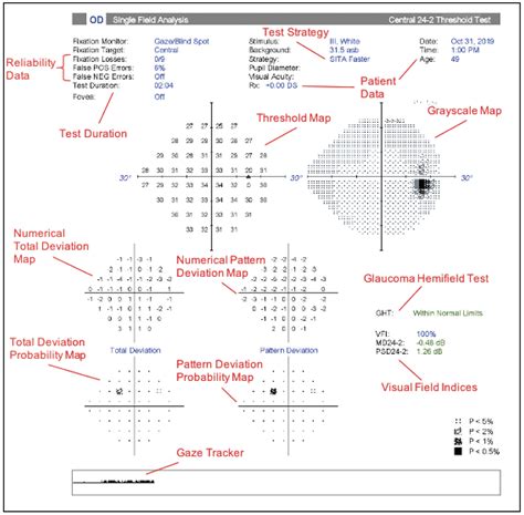 what is visual image interpretation