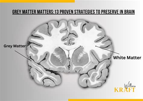 what reduces grey matter in the brain