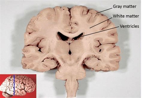 what structure forms the majority of grey matter in the nervous system