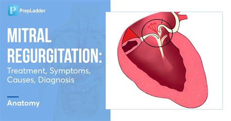 what to avoid with mitral regurgitation