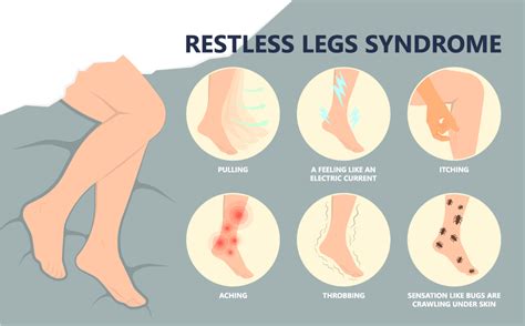 what to do for restless leg syndrome