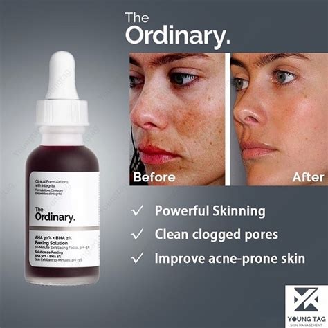 what to put on face after using the ordinary peeling solution