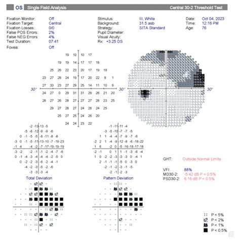 where can i get a visual field test