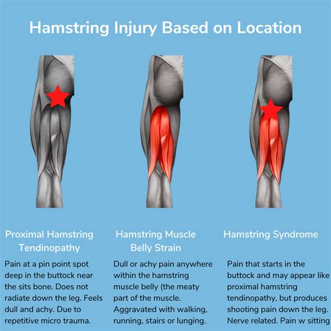 why are my hamstrings so sore after working out