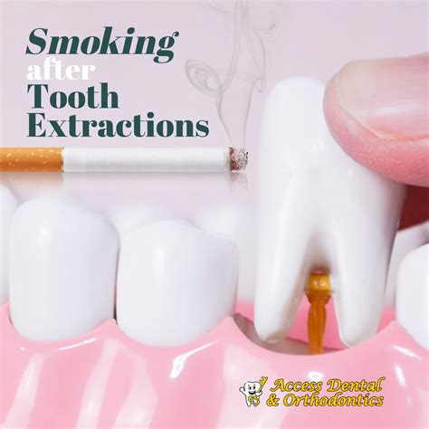 why avoid smoking after tooth extraction