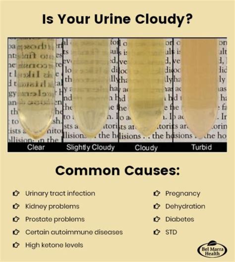 why is my pee cloudy yellow