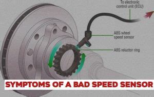 will a bad speed sensor throw a code